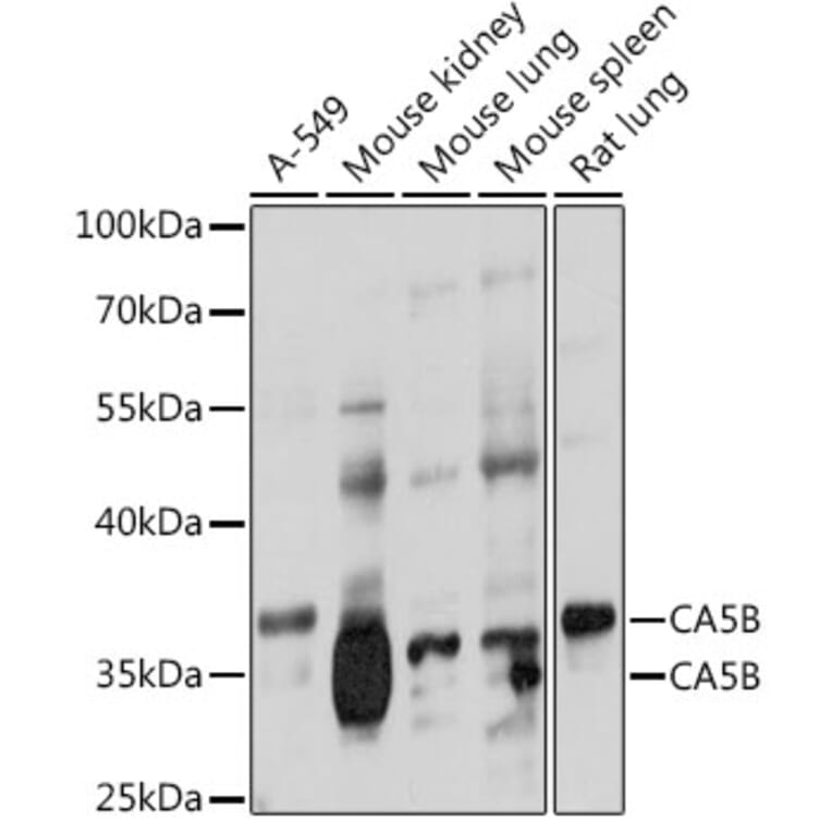 Western Blot - Anti-Carbonic Anhydrase 5B/CA5B Antibody (A307995) - Antibodies.com