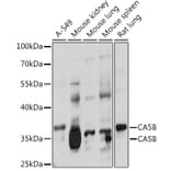 Western Blot - Anti-Carbonic Anhydrase 5B/CA5B Antibody (A307995) - Antibodies.com