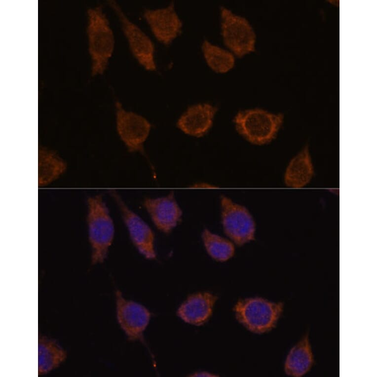 Immunofluorescence - Anti-Carbonic Anhydrase 5B/CA5B Antibody (A307995) - Antibodies.com