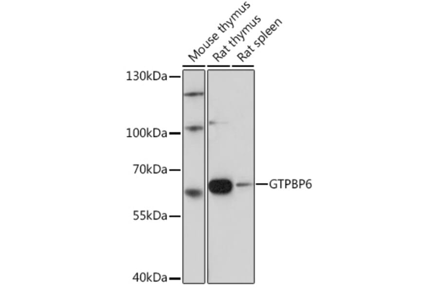 Western Blot - Anti-PGPL Antibody (A307996) - Antibodies.com