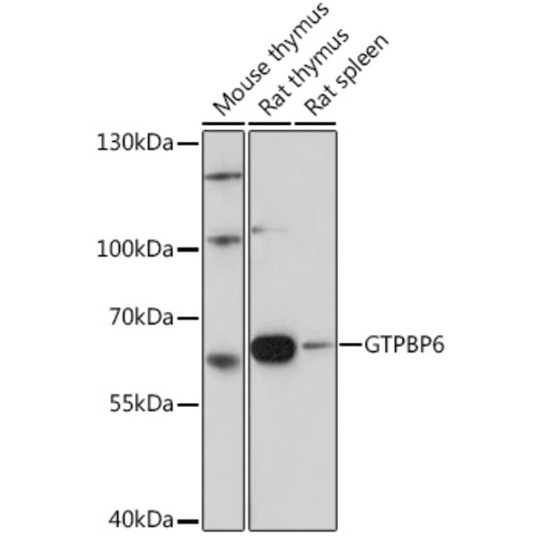 Western Blot - Anti-PGPL Antibody (A307996) - Antibodies.com