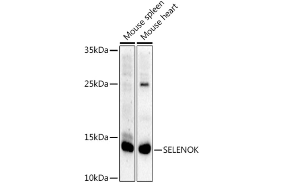 Western Blot - Anti-SELK Antibody (A307997) - Antibodies.com