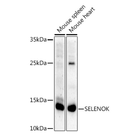 Western Blot - Anti-SELK Antibody (A307997) - Antibodies.com