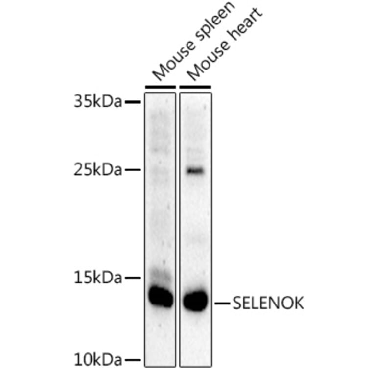 Western Blot - Anti-SELK Antibody (A307997) - Antibodies.com