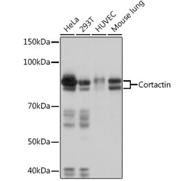 Western Blot - Anti-Cortactin Antibody [ARC1613] (A307999) - Antibodies.com