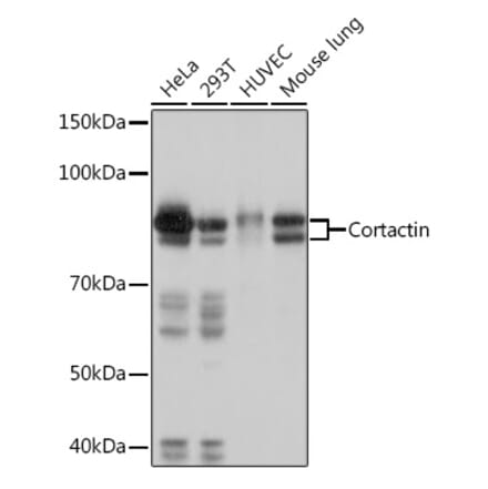 Western Blot - Anti-Cortactin Antibody [ARC1613] (A307999) - Antibodies.com