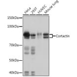 Western Blot - Anti-Cortactin Antibody [ARC1613] (A307999) - Antibodies.com