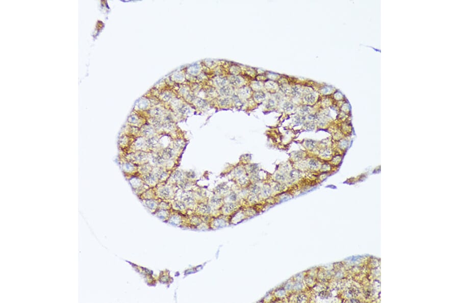 Immunohistochemistry - Anti-Cortactin Antibody [ARC1613] (A307999) - Antibodies.com