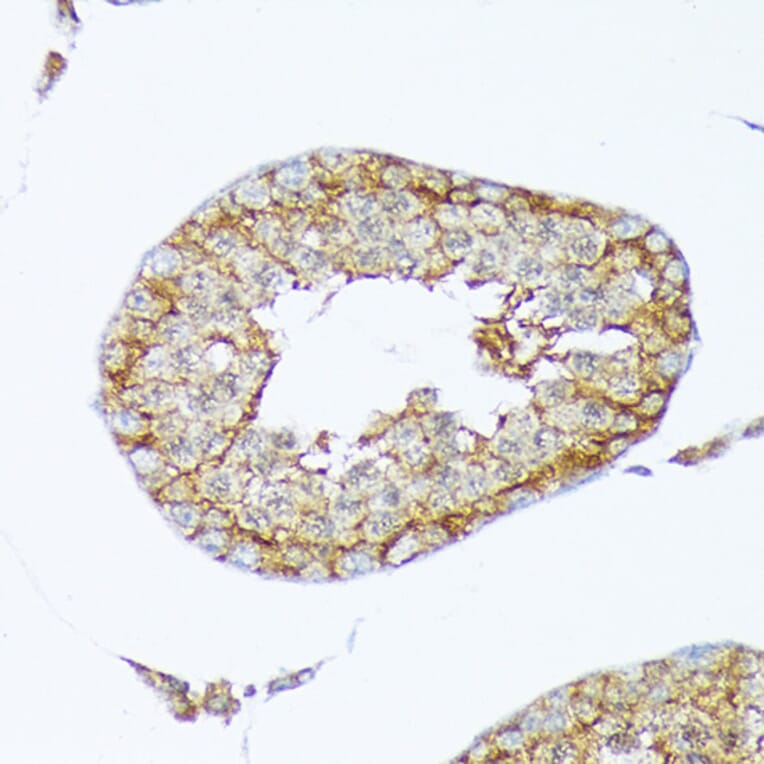 Immunohistochemistry - Anti-Cortactin Antibody [ARC1613] (A307999) - Antibodies.com