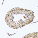 Immunohistochemistry - Anti-Cortactin Antibody [ARC1613] (A307999) - Antibodies.com