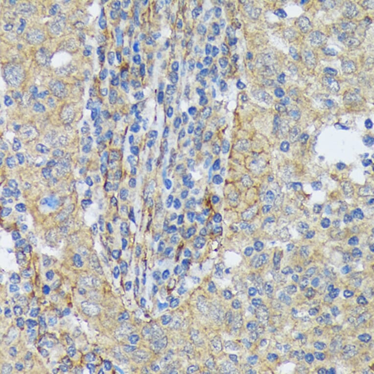 Immunohistochemistry - Anti-Cortactin Antibody [ARC1613] (A307999) - Antibodies.com