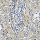 Immunohistochemistry - Anti-Cortactin Antibody [ARC1613] (A307999) - Antibodies.com