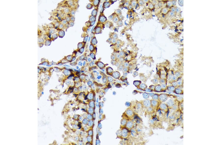 Immunohistochemistry - Anti-Cortactin Antibody [ARC1613] (A307999) - Antibodies.com
