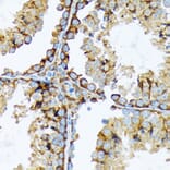 Immunohistochemistry - Anti-Cortactin Antibody [ARC1613] (A307999) - Antibodies.com