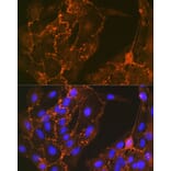 Immunofluorescence - Anti-Cortactin Antibody [ARC1613] (A307999) - Antibodies.com