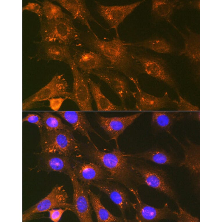 Immunofluorescence - Anti-Cortactin Antibody [ARC1613] (A307999) - Antibodies.com