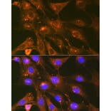 Immunofluorescence - Anti-Cortactin Antibody [ARC1613] (A307999) - Antibodies.com