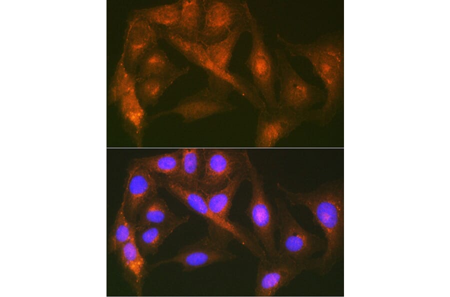 Immunofluorescence - Anti-Cortactin Antibody [ARC1613] (A307999) - Antibodies.com