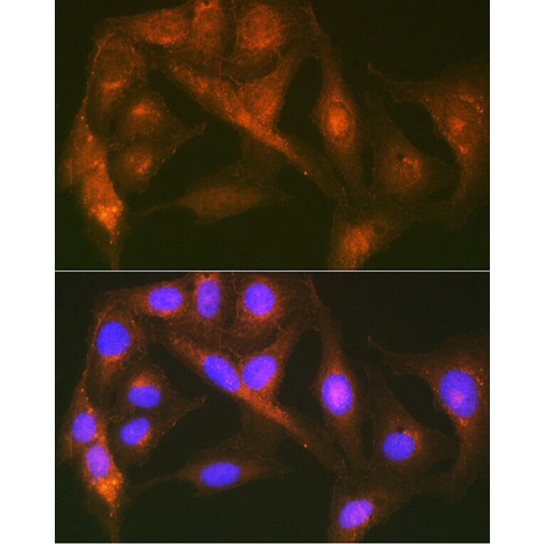 Immunofluorescence - Anti-Cortactin Antibody [ARC1613] (A307999) - Antibodies.com