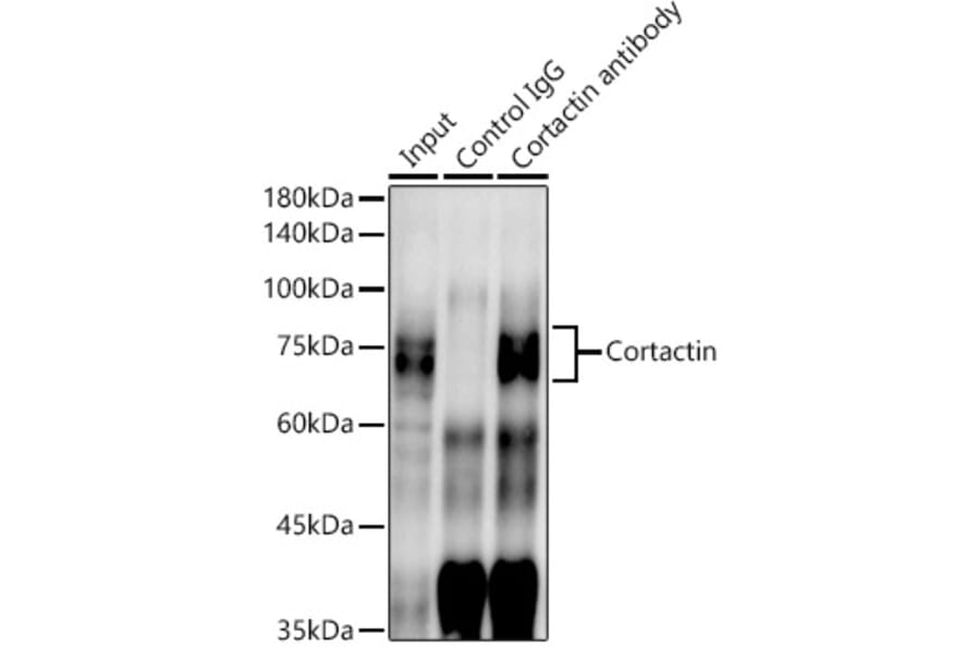Western Blot - Anti-Cortactin Antibody [ARC1613] (A307999) - Antibodies.com