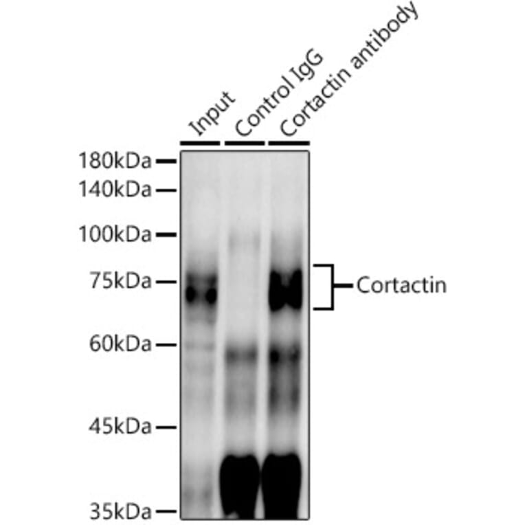 Western Blot - Anti-Cortactin Antibody [ARC1613] (A307999) - Antibodies.com