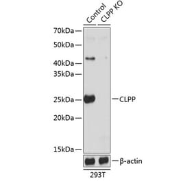 Western Blot - Anti-CLPP Antibody (A308001) - Antibodies.com