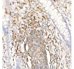 Immunohistochemistry - Anti-CMTM3 Antibody (A308002) - Antibodies.com