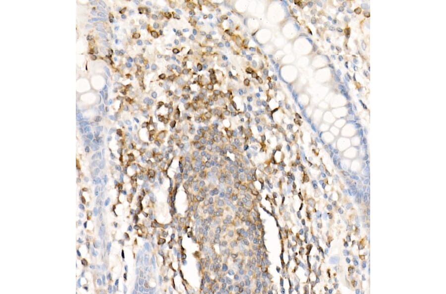 Immunohistochemistry - Anti-CMTM3 Antibody (A308002) - Antibodies.com
