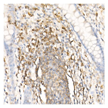 Immunohistochemistry - Anti-CMTM3 Antibody (A308002) - Antibodies.com