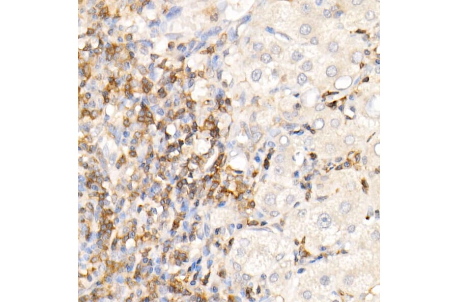 Immunohistochemistry - Anti-CMTM3 Antibody (A308002) - Antibodies.com