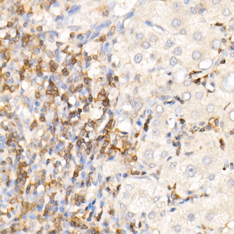 Immunohistochemistry - Anti-CMTM3 Antibody (A308002) - Antibodies.com