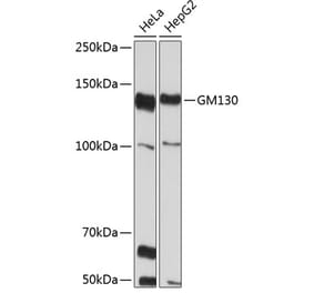 Western Blot - Anti-GM130 Antibody [ARC0589] (A308003) - Antibodies.com
