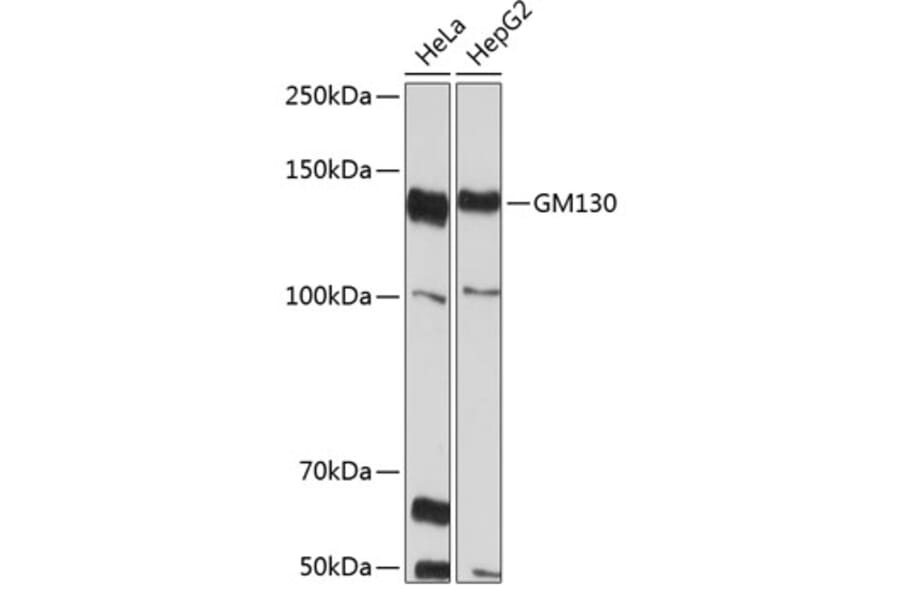 Western Blot - Anti-GM130 Antibody [ARC0589] (A308003) - Antibodies.com