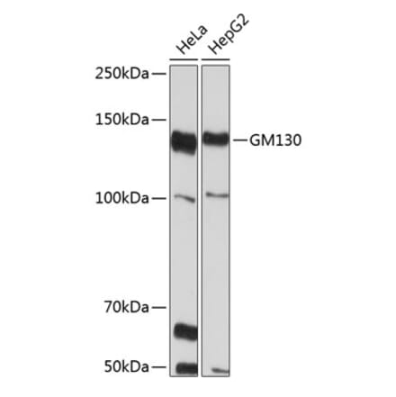 Western Blot - Anti-GM130 Antibody [ARC0589] (A308003) - Antibodies.com