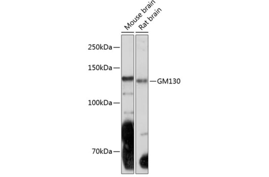 Western Blot - Anti-GM130 Antibody [ARC0589] (A308003) - Antibodies.com