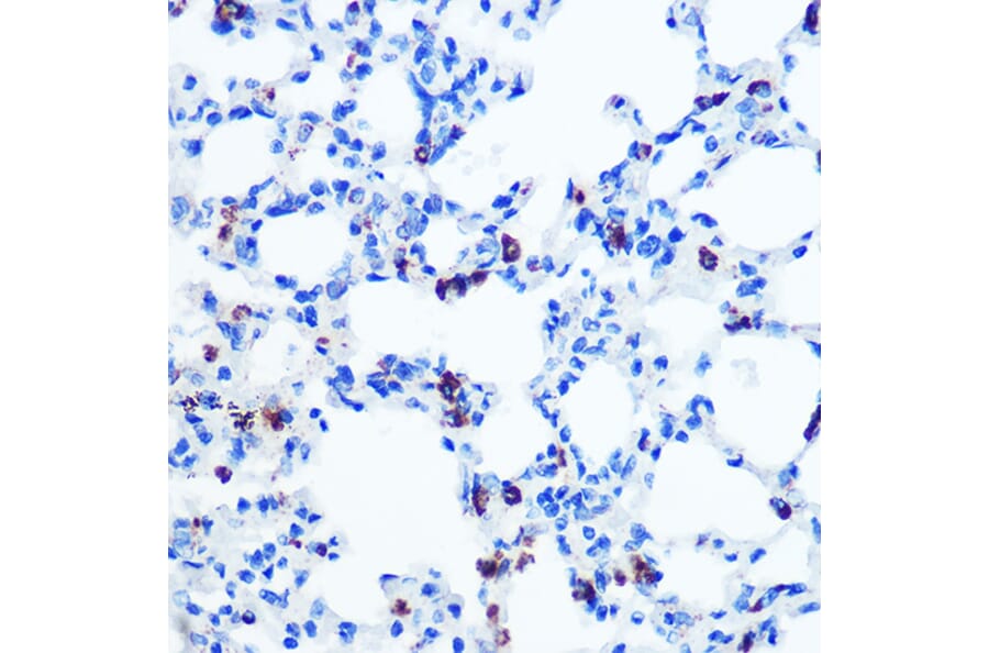Immunohistochemistry - Anti-GM130 Antibody [ARC0589] (A308003) - Antibodies.com