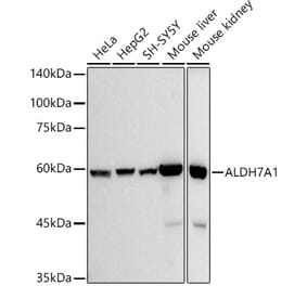 Western Blot - Anti-ALDH7A1 Antibody [ARC2837] (A308004) - Antibodies.com