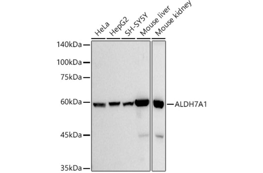 Western Blot - Anti-ALDH7A1 Antibody [ARC2837] (A308004) - Antibodies.com