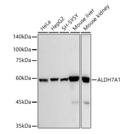 Western Blot - Anti-ALDH7A1 Antibody [ARC2837] (A308004) - Antibodies.com