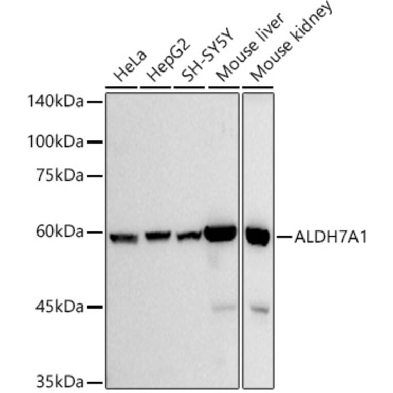 Western Blot - Anti-ALDH7A1 Antibody [ARC2837] (A308004) - Antibodies.com