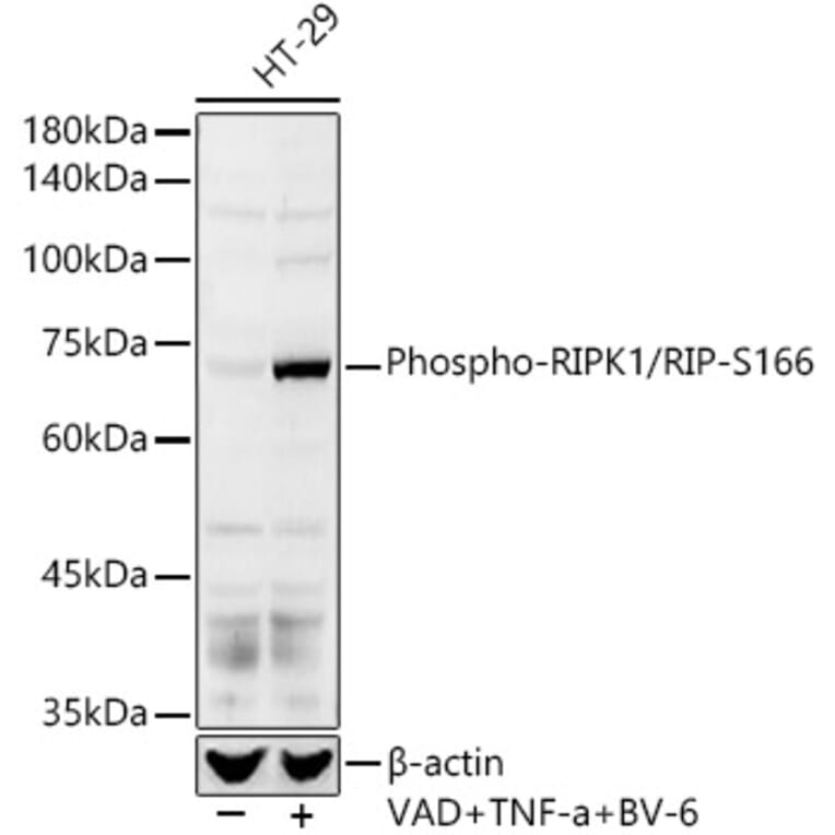 Western Blot - Anti-RIP (phospho Ser166) Antibody (A308005) - Antibodies.com