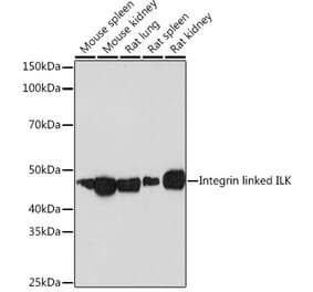 Western Blot - Anti-Integrin linked ILK Antibody [ARC1037] (A308006) - Antibodies.com