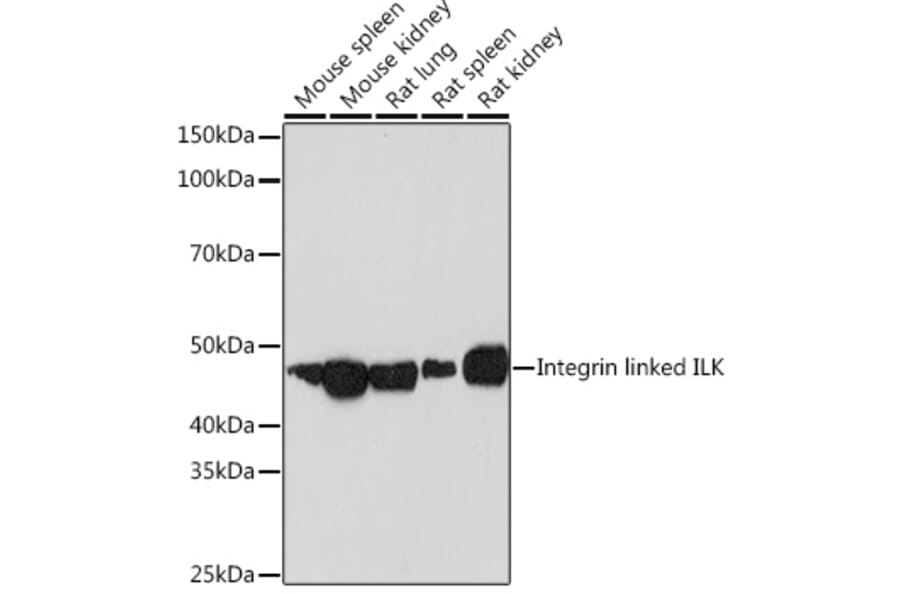 Western Blot - Anti-Integrin linked ILK Antibody [ARC1037] (A308006) - Antibodies.com