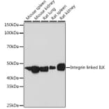 Western Blot - Anti-Integrin linked ILK Antibody [ARC1037] (A308006) - Antibodies.com