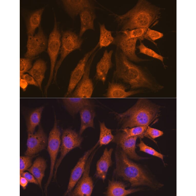 Immunofluorescence - Anti-GUCY1B3 Antibody [ARC2071] (A308007) - Antibodies.com