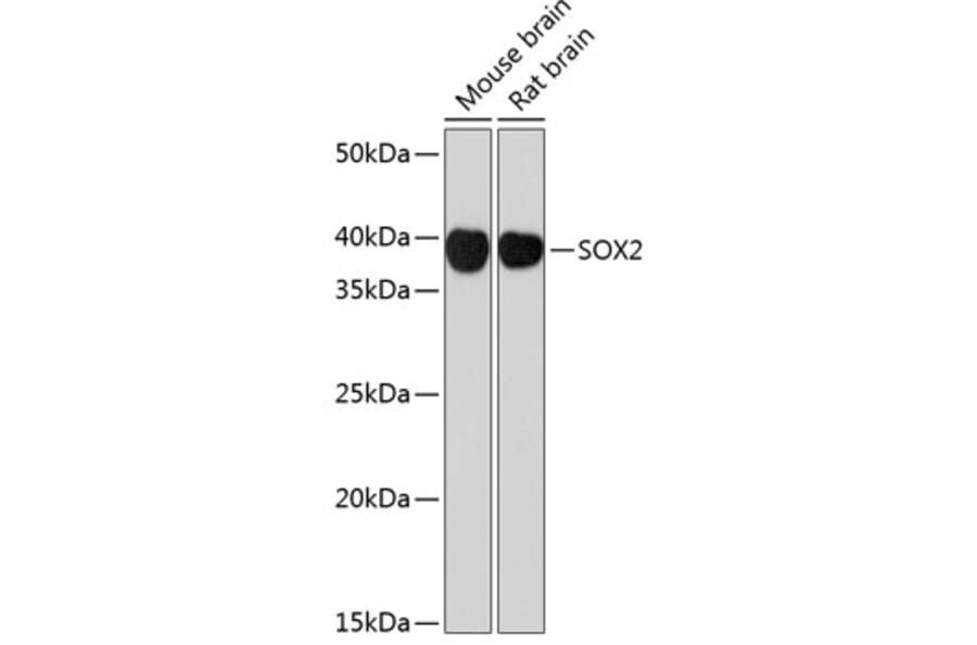 Western Blot - Anti-SOX2 Antibody [ARC0449] (A308010) - Antibodies.com