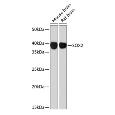 Western Blot - Anti-SOX2 Antibody [ARC0449] (A308010) - Antibodies.com