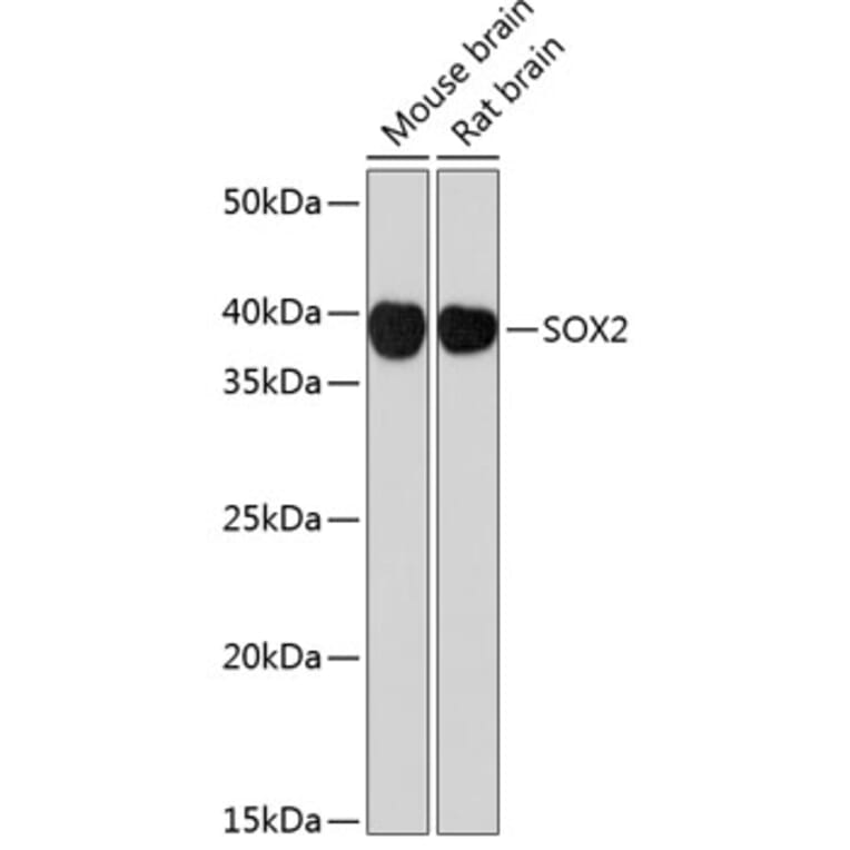 Western Blot - Anti-SOX2 Antibody [ARC0449] (A308010) - Antibodies.com