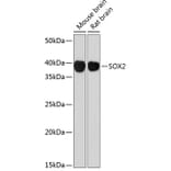 Western Blot - Anti-SOX2 Antibody [ARC0449] (A308010) - Antibodies.com