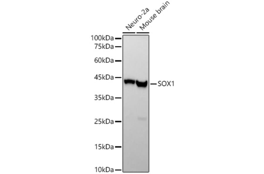 Western Blot - Anti-SOX1 Antibody [ARC2100] (A308012) - Antibodies.com